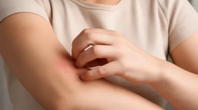 Waspada! Gatal di Area Tertentu Bisa Jadi Tanda Infeksi Jamur atau Scabies